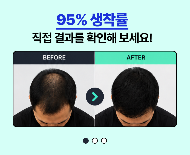 95% 생착률 — 세트 1