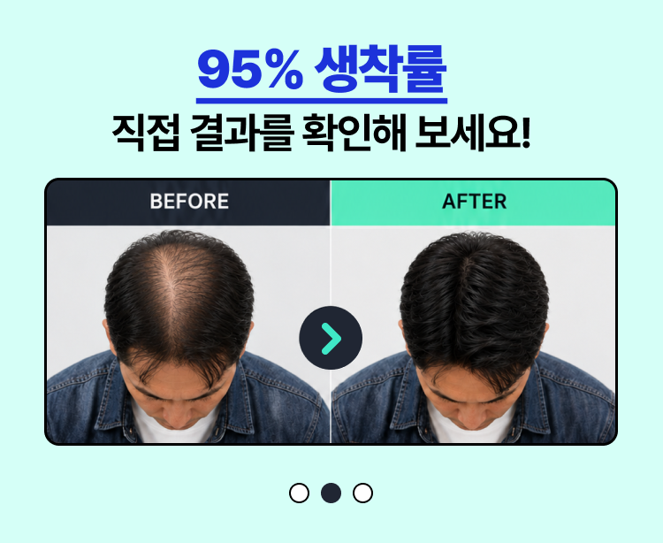95% 생착률 — 세트 2
